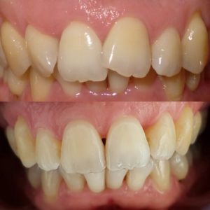 Sleaford Invisalign Smiles