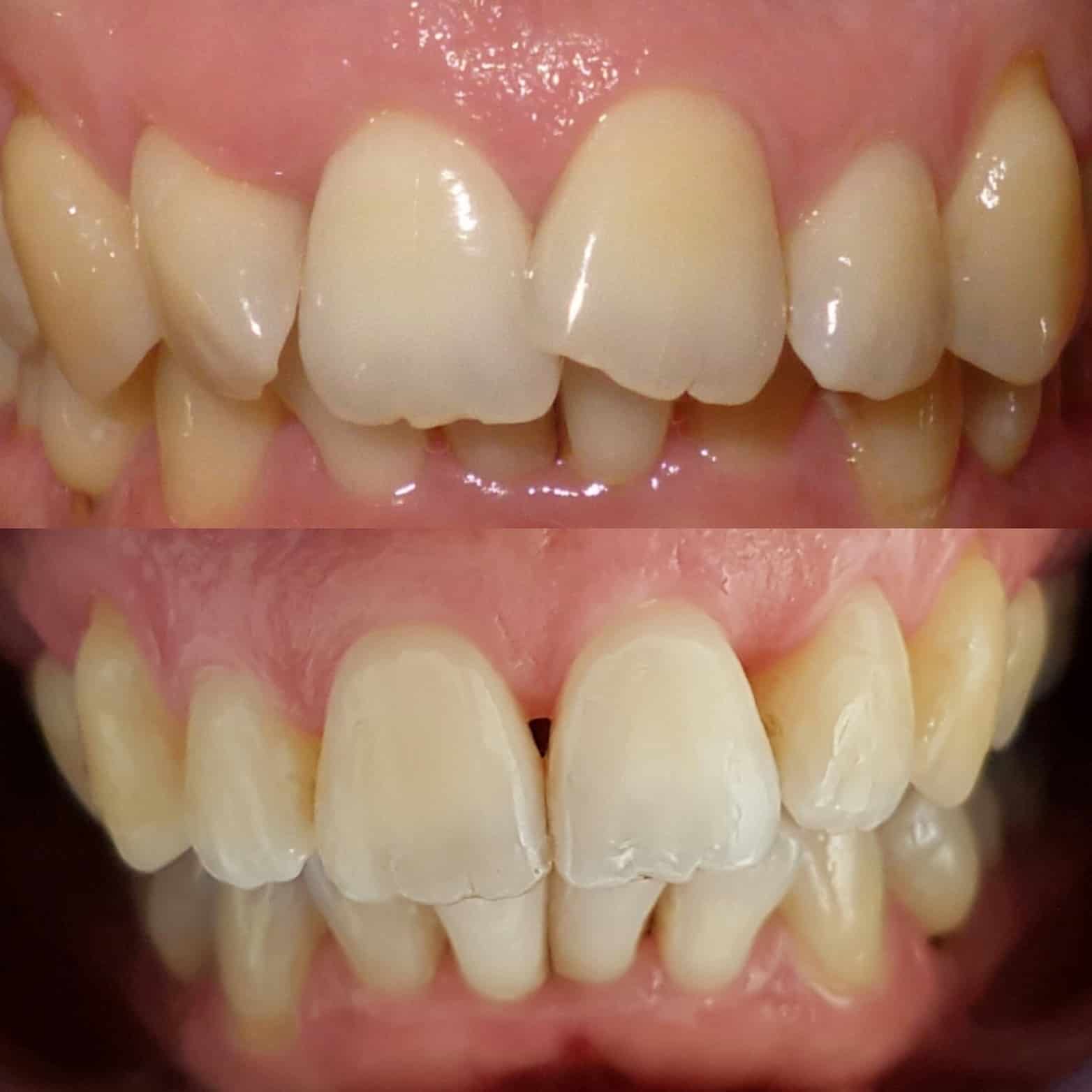 Sleaford Invisalign Smiles